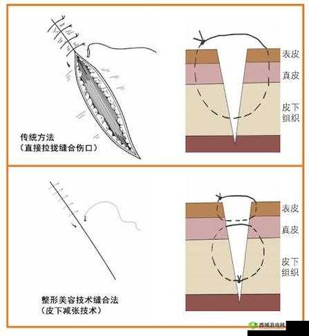 竹板打肿臂缝合不上:真的很离奇